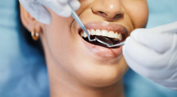 Best Emergency Treatment for Dental Infections or Abscesses in Cedar Hills, UT