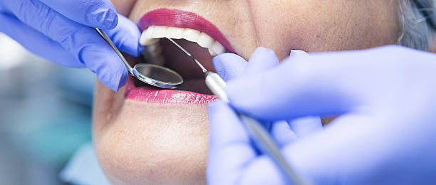 Best Emergency Dental Care for Broken or Chipped Teeth in Cedar Hills, UT
